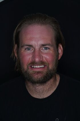 Before and After Case 16 - Before