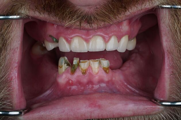 Before and After: Case 16 - Before