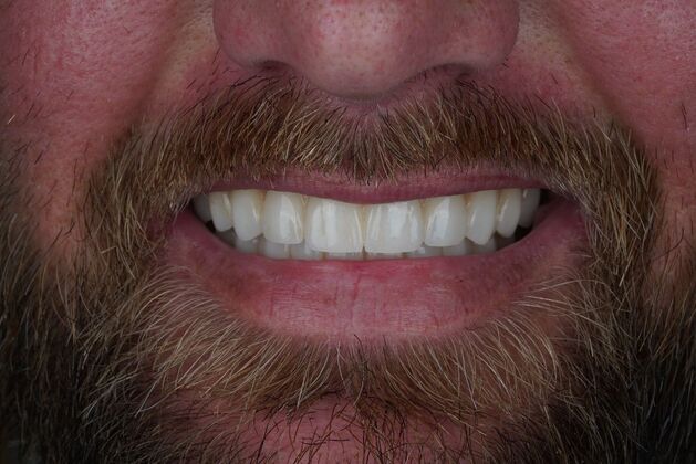 Before and After: Case 16 - After