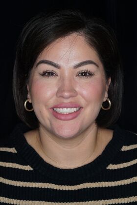 Before and After Case 17 - After