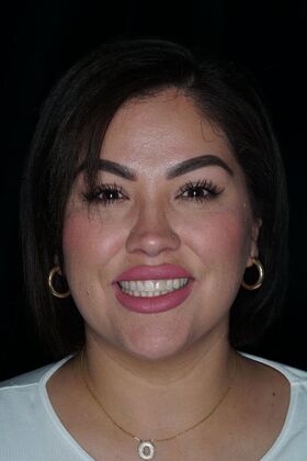 Before and After Case 17 - Before