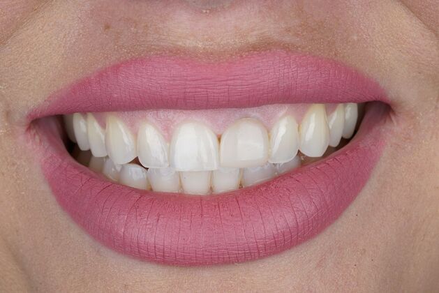 Before and After: Case 17 - Before