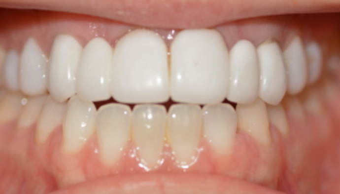 Smile Makeover Case 2 - Before