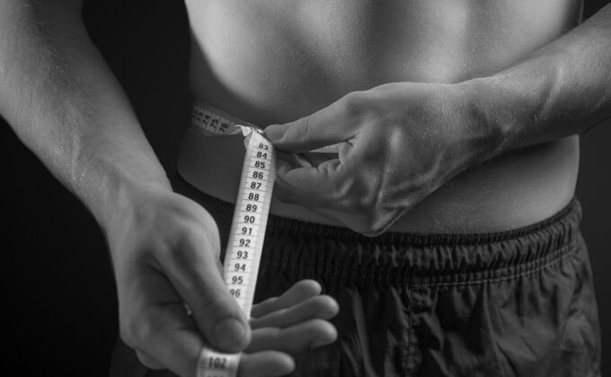 Massive Weight Loss Surgery Cases