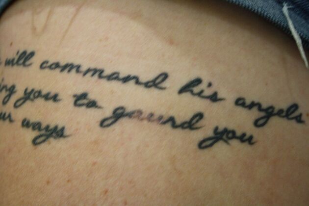 Laser Tattoo Removal Case 48 - Before