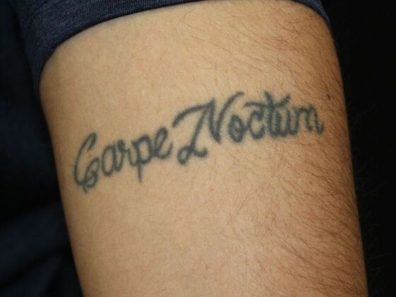 Laser Tattoo Removal Case 51 - Before