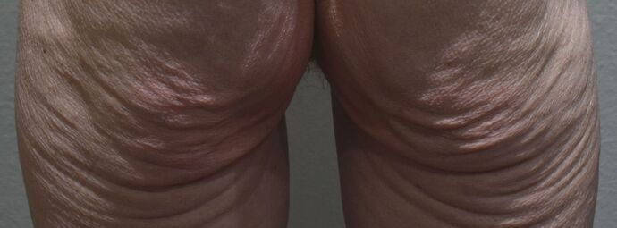 Advanced Non-Surgical Treatments Case 3 - Before