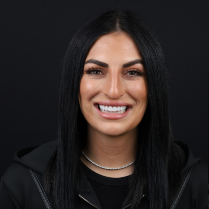 No Prep Porcelain Veneers Daria Rae - After