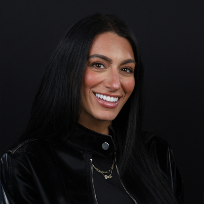 No Prep Porcelain Veneers Toni - After