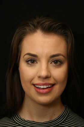 Dental Crowns & Veneers Case 2 - Before