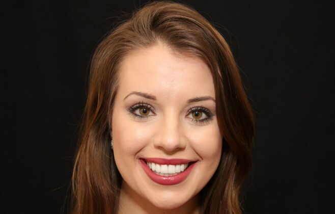 Dental Crowns & Veneers: Case 2 - After