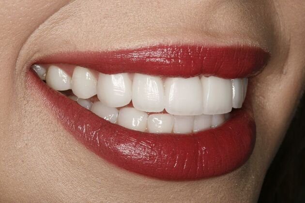 Dental Crowns & Veneers: Case 2 - Before