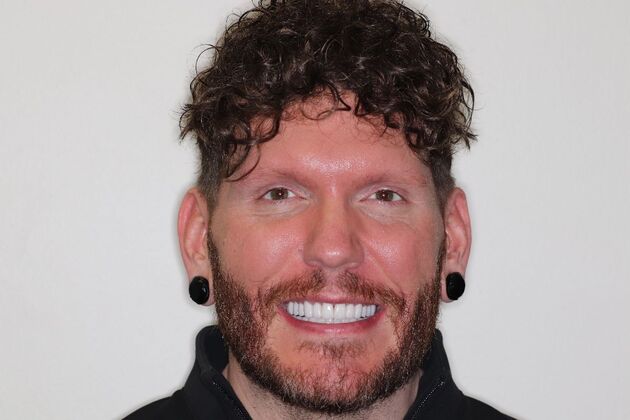 Smile Makeover Case
