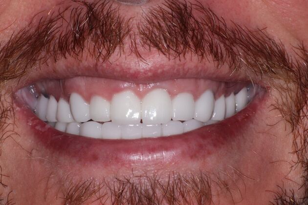 Smile Makeover: Travis - Before