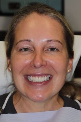 Cosmetic Dentistry Alex - After