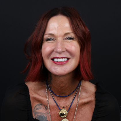 Minimal Prep Porcelain Veneers: Mary Beth - After