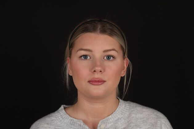 Face & Neck Lifts: Case 61 - Before