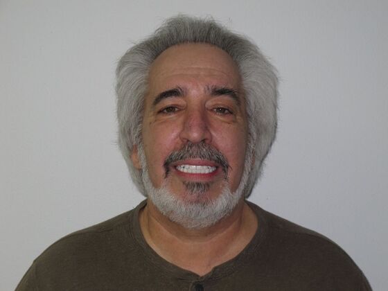 Full Mouth Implants: 10-Year Full-Mouth Implant Result That Still Feels Natural - After