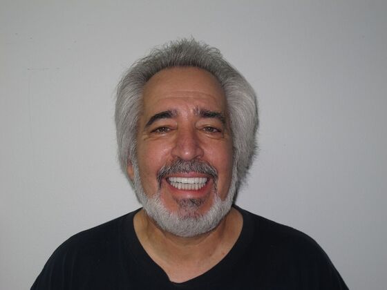 Full Mouth Implants: 10-Year Full-Mouth Implant Result That Still Feels Natural - 2016 Result