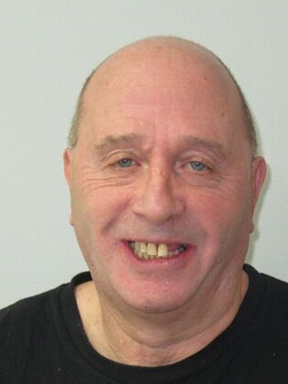Full Mouth Implants: Full-Mouth Implants for Severely Decayed, Eroded, and Missing Teeth - Before