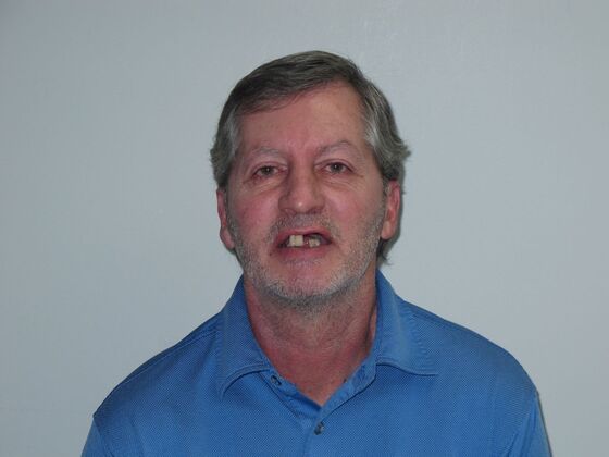 Full Mouth Implants Full-Mouth Implants for Missing Front Teeth and Severe Dental Breakdown - Before