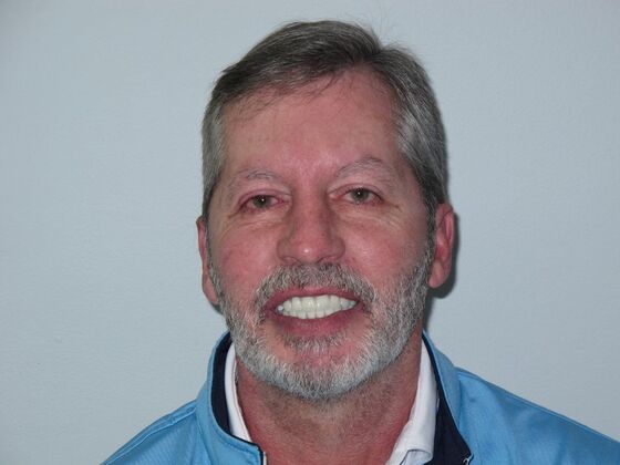 Full Mouth Implants Full-Mouth Implants for Missing Front Teeth and Severe Dental Breakdown - After