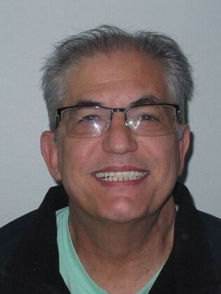 Full Mouth Implants Full-Mouth Implants After Failing Bridges and Years of Discomfort - After