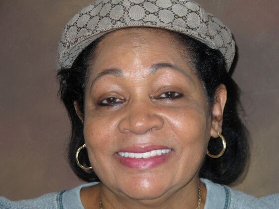 Full Mouth Implants: Full Mouth Implants After Dentures, Fear, and Hiding Her Smile - After