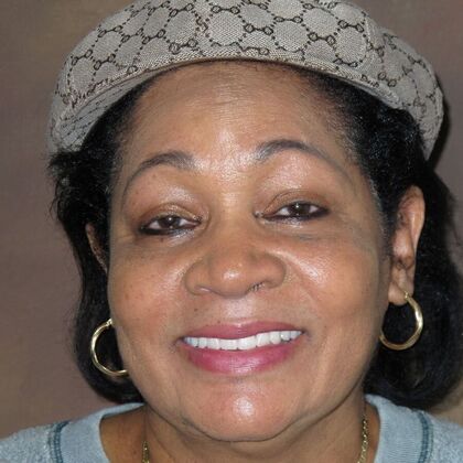 Full Mouth Implants Princess Stopped Hiding Her Smile After Full Mouth Implants - After
