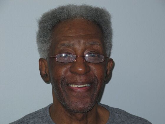 Full Mouth Implants: Full Mouth Implants After Missing Front Teeth and Partial Denture Worry - After