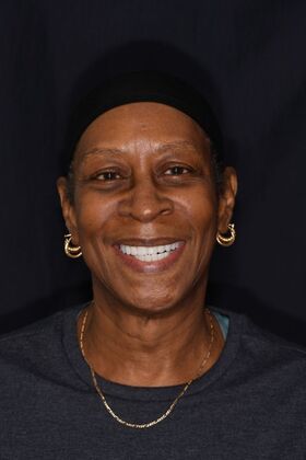 Full Mouth Implants: Full Mouth Implants After Dental Pain, Anxiety, and a Broken Partial - After