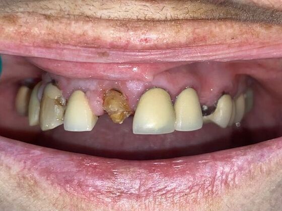 Dr. Andrews Work  Joy Kauper - Before