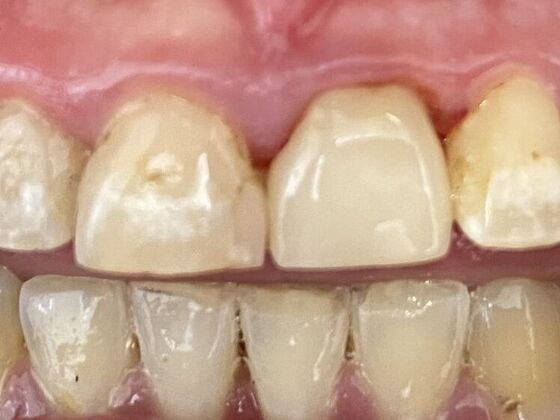 Dr. Andrews Work  Mathew Bailey  - After