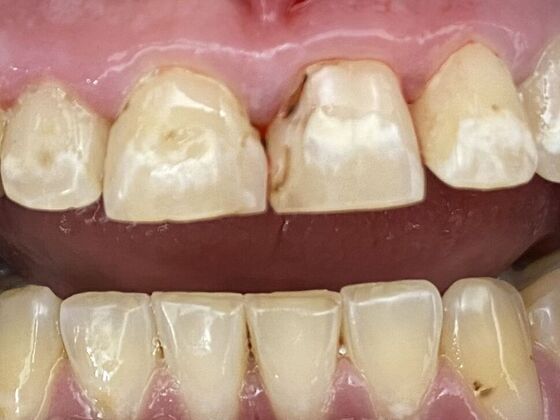 Dr. Andrews Work  Mathew Bailey  - Before