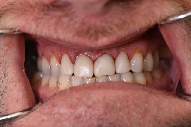 Dr. Andrews Work  Matthew Cole  - After