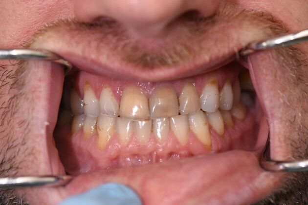Dr. Andrews Work  Matthew Cole  - Before