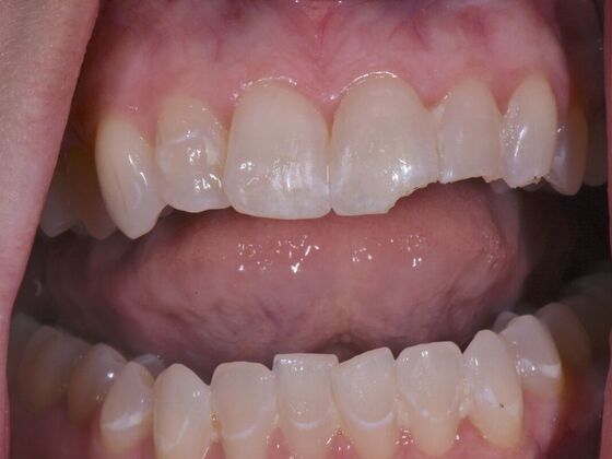 Dr. Andrews Work  Angela Coker  - Before