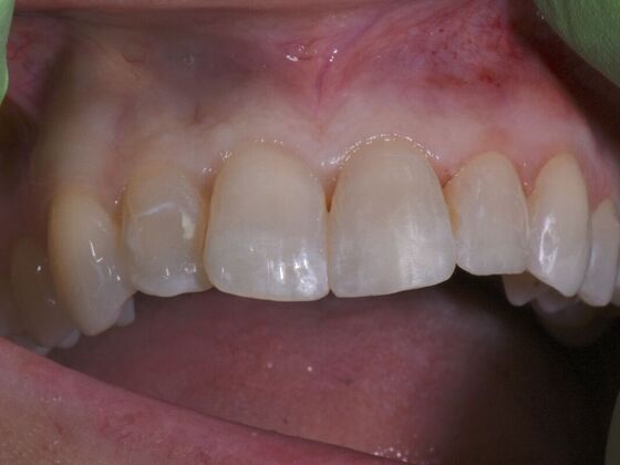 Dr. Andrews Work  Angela Coker  - After
