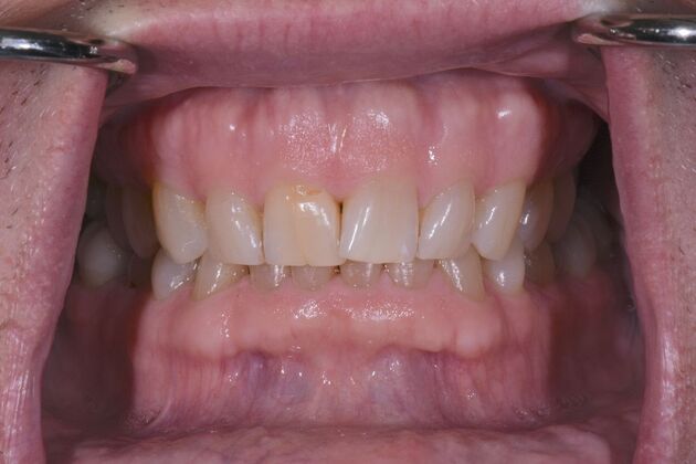 Dr. Andrews Work  Cass Houck  - Before