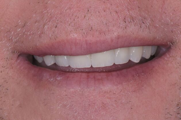 Dr. Andrews Work : Cass Houck - After