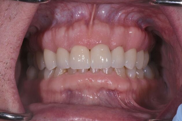 Dr. Andrews Work  Cass Houck  - After