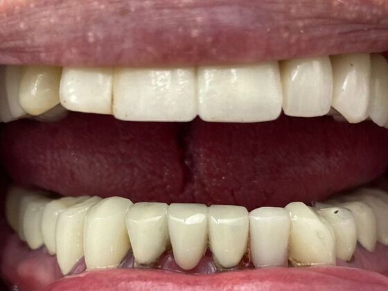 Dr. Andrews Work  Louie Hollis  - After