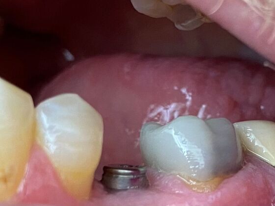 Dr. Andrews Work  Todd Devasure  - Before
