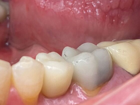 Dr. Andrews Work  Todd Devasure  - After