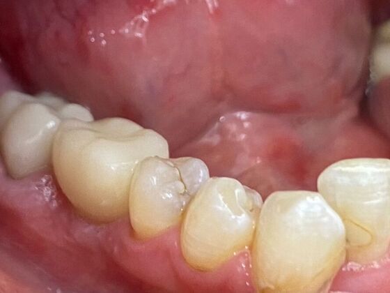 Dr. Andrews Work : Todd Devasure - After