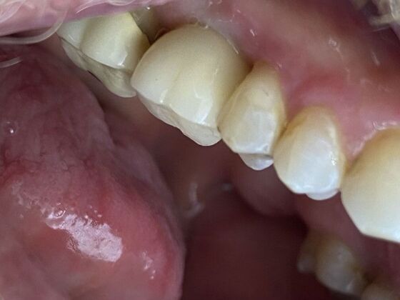 Dr. Andrews Work : Todd Devasure - After