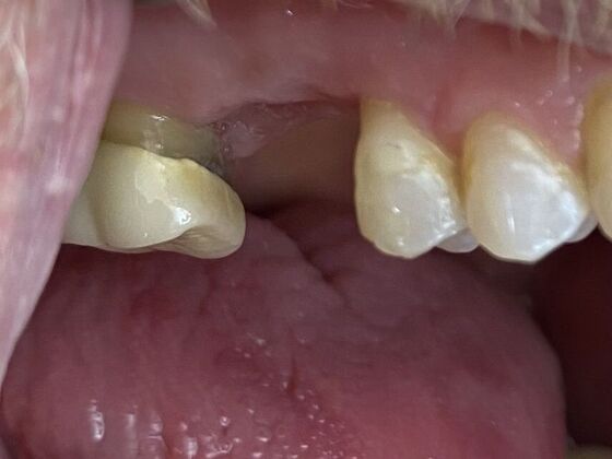 Dr. Andrews Work : Todd Devasure - Before