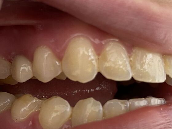 Dr. Andrews Work  Danny Sanchez  - After