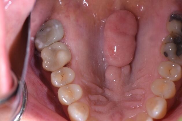 Dr. Andrews Work  Janet Hinson  - After