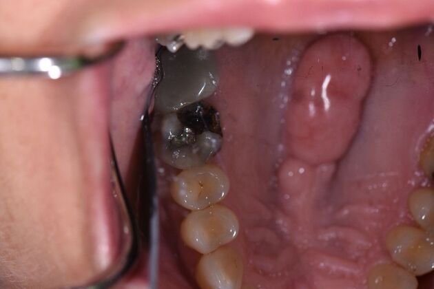 Dr. Andrews Work  Janet Hinson  - Before